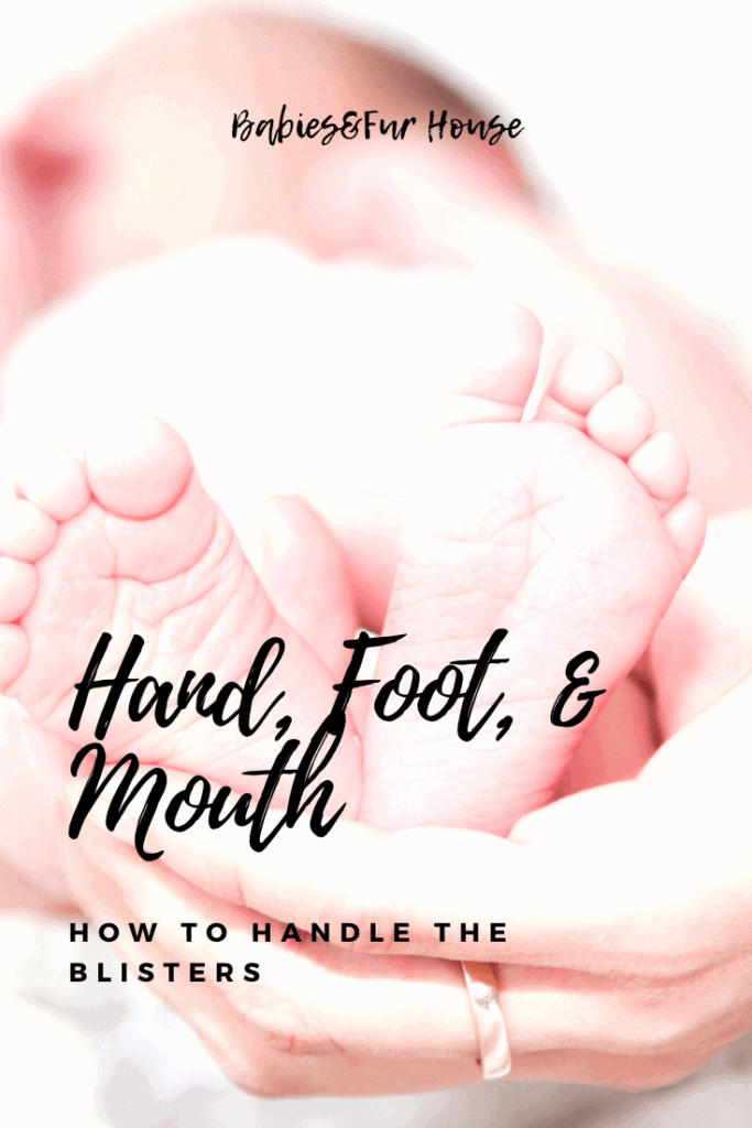 Hand, Foot, and Mouth Disease: Handling The Blisters #HFMD #HFM